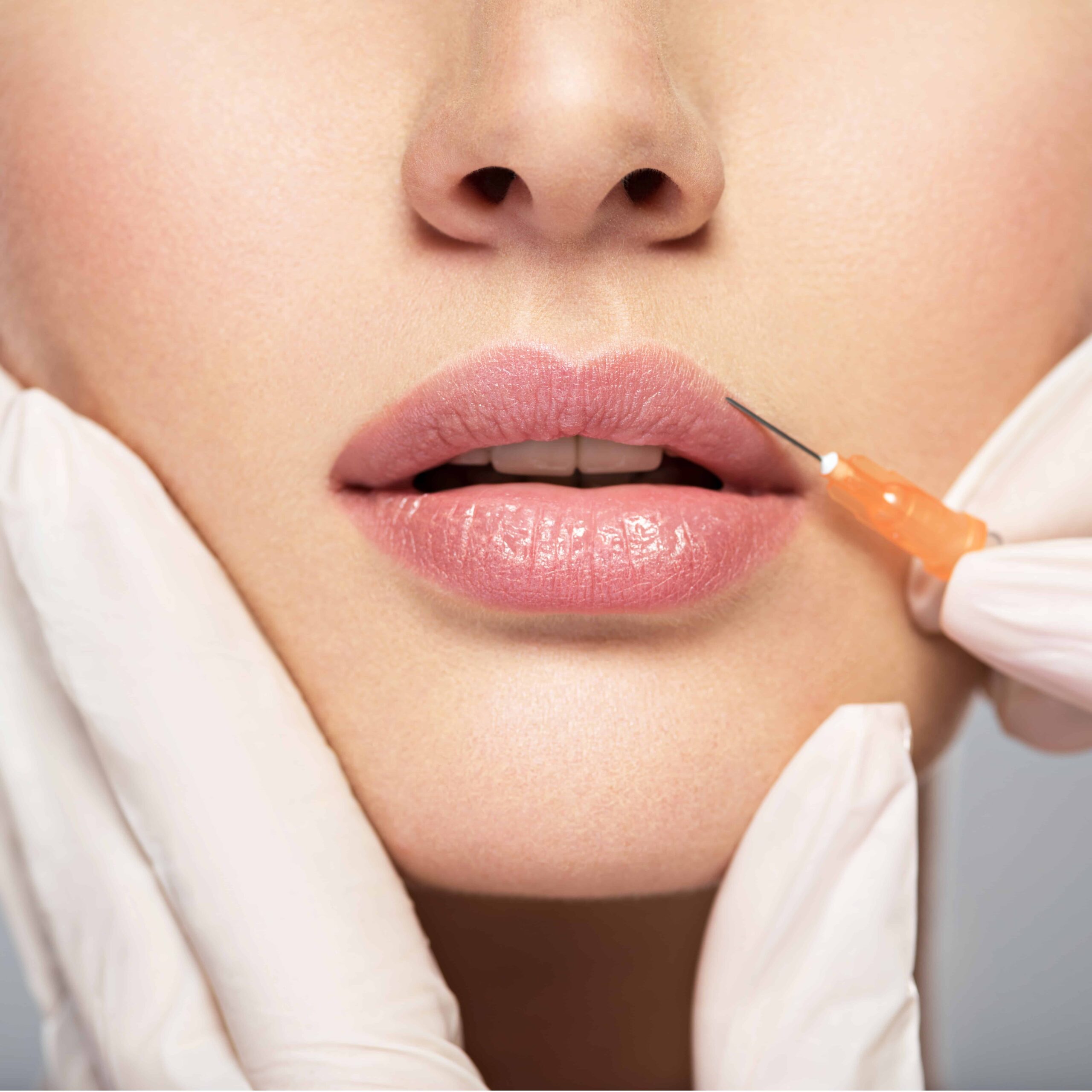 shutterstock lip filler scaled