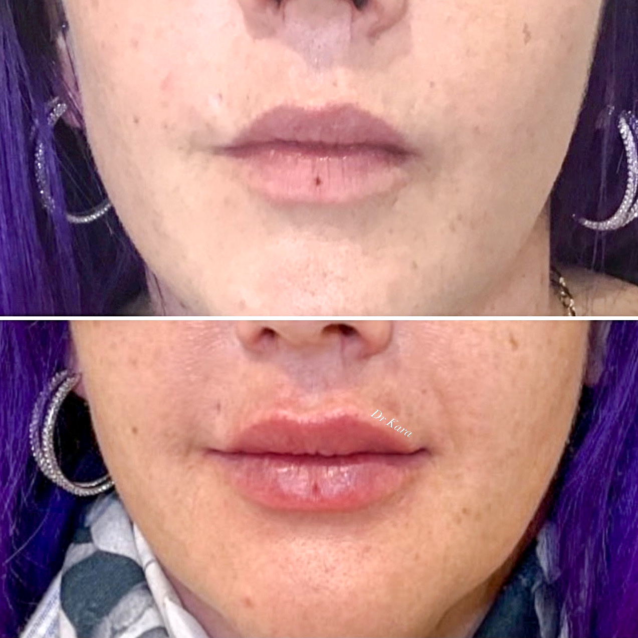 MC Lips