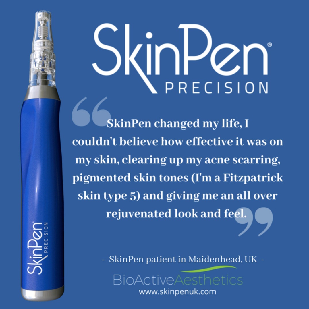 skinpen review