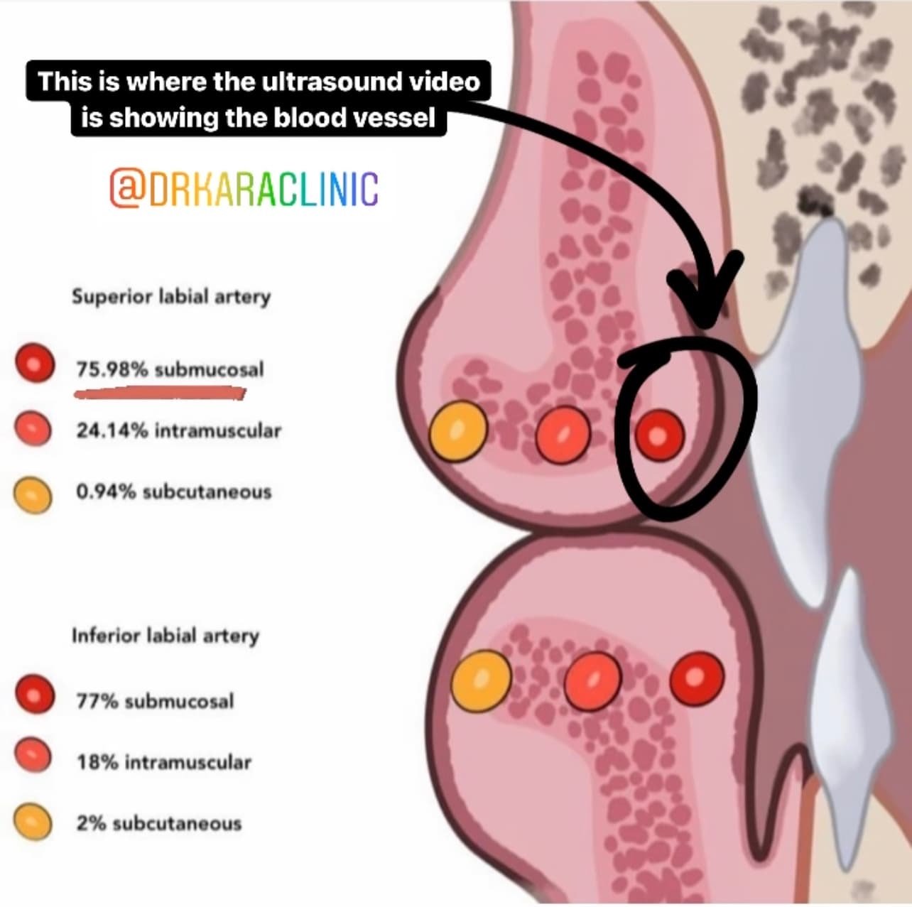 Lip cross sectional diagram anatomy, Dr Kara Cosmetic Clinic