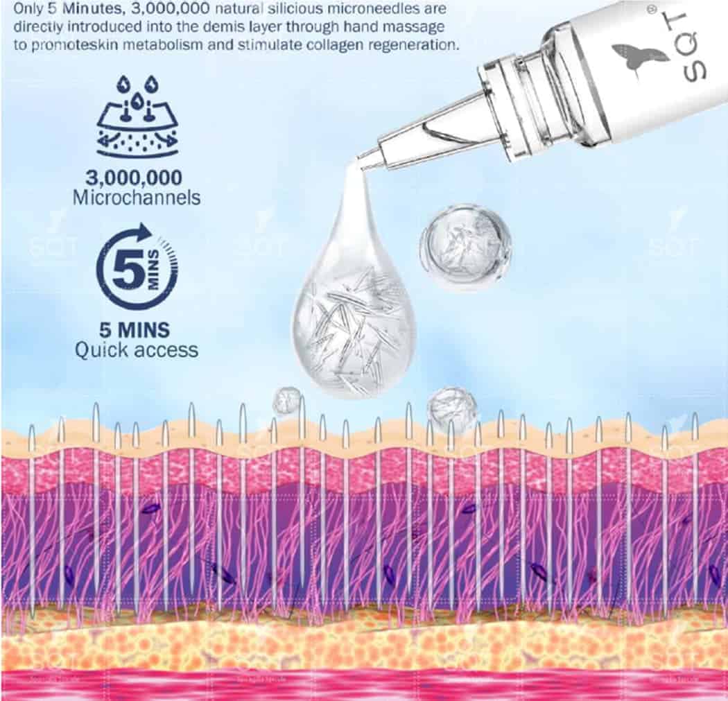 SQT Bio Microneedling , Norwich , Norfolk , UK