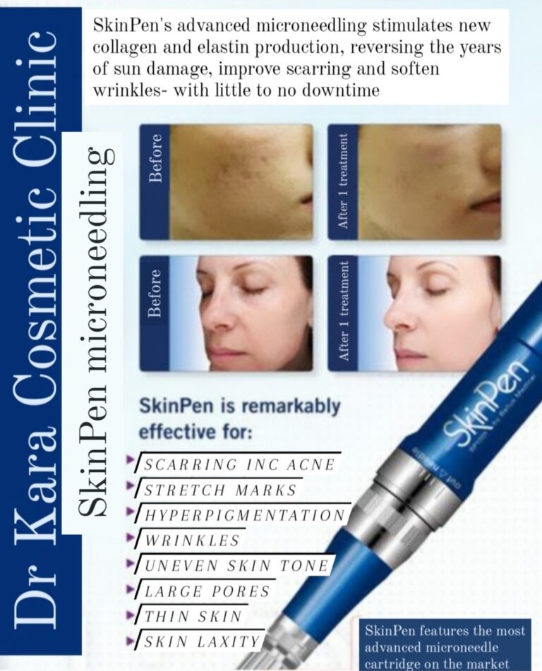 Treatments 20 Dr Kara Cosmetic Clinic SkinPen microneedling leaflet with before and after photos