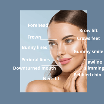 Anti wrinkle Botox treatment areas Anti wrinkle Botox treatment areas