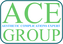 ACE